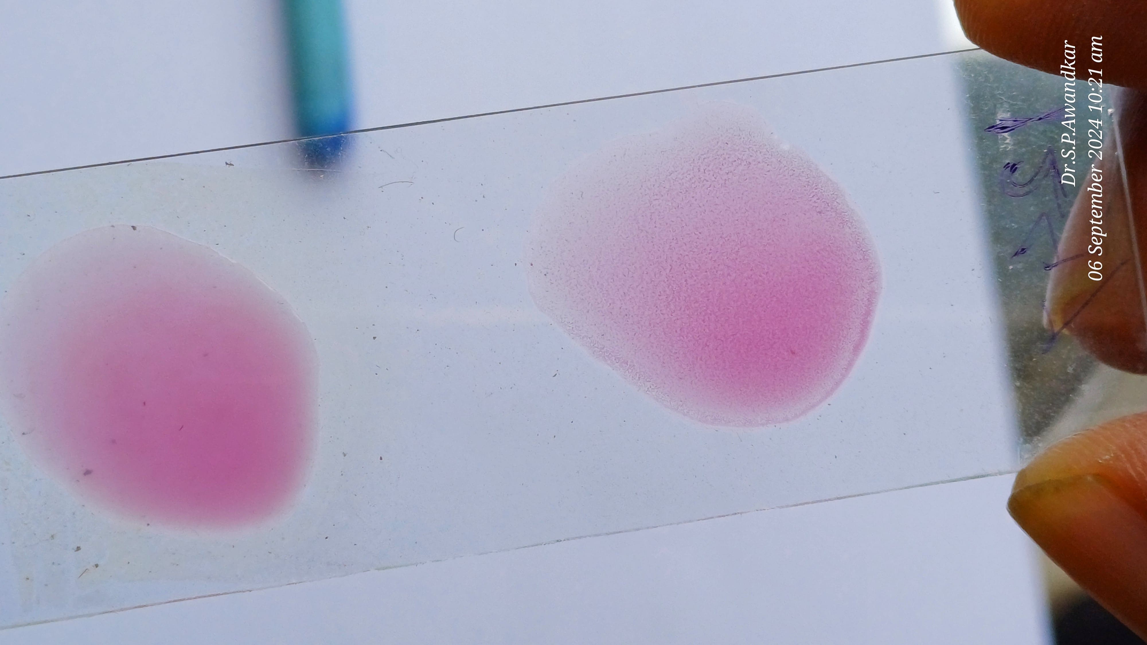45. Plate Agglutination Test